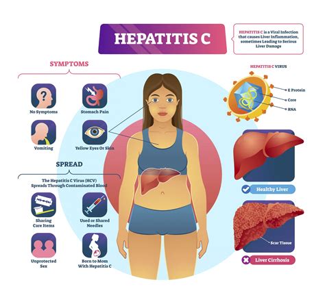 what viruses are similar to hepatitis c